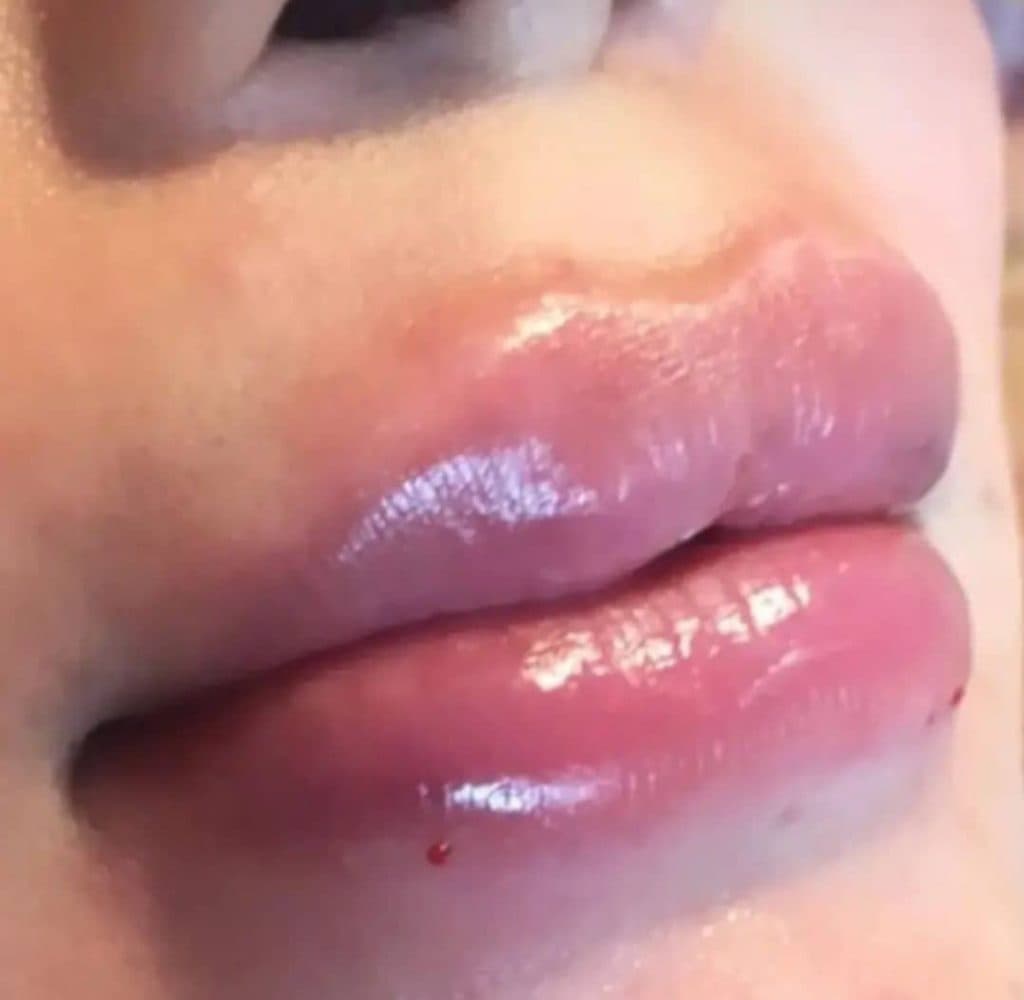 کلینیک تخصصی پوست و مو سوگند شکیبا در قائم شهر