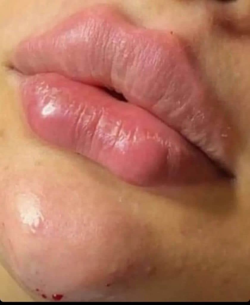 کلینیک تخصصی پوست و مو سوگند شکیبا در قائم شهر
