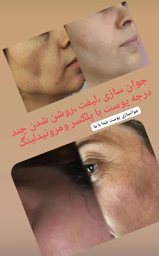خدمات تخصصی پاکسازی و جوانسازی پوست سهیلا توحیدلو در زنجان