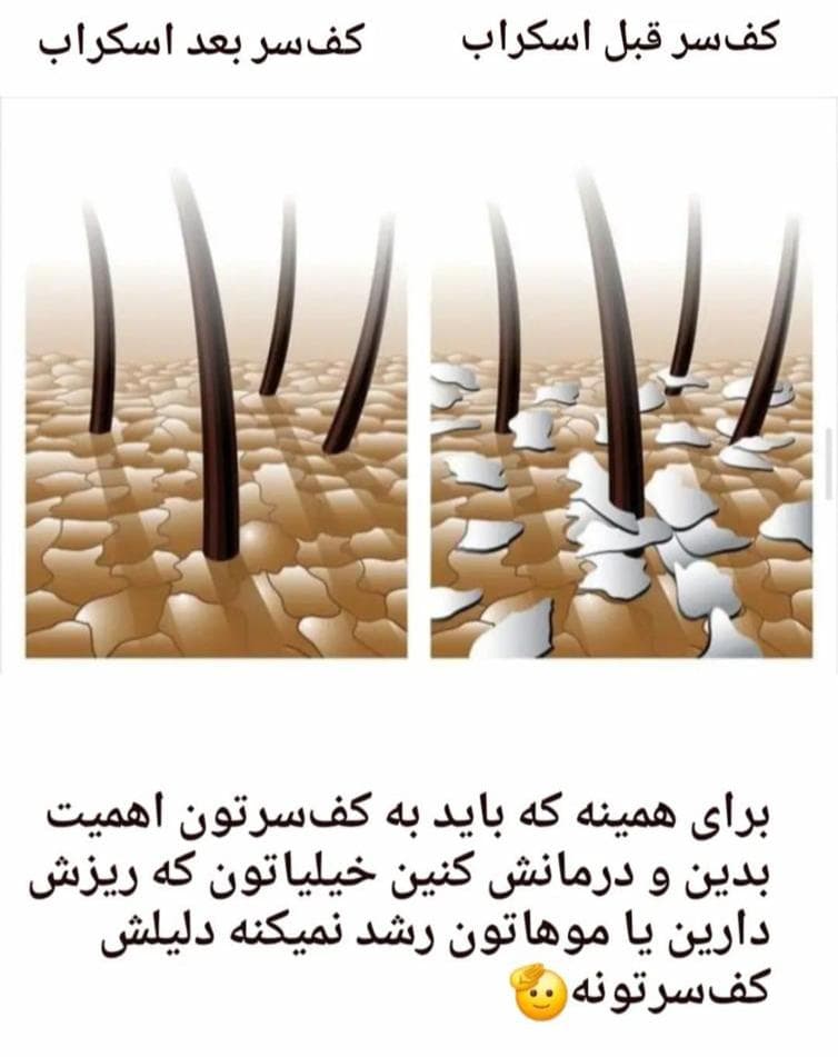 مرکز تخصصی اسکالپ و پاکسازی پوست سر زیبا عسکری در رفسنجان