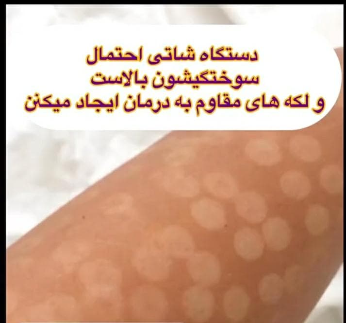 مرکز لیزر پرشین در یزد