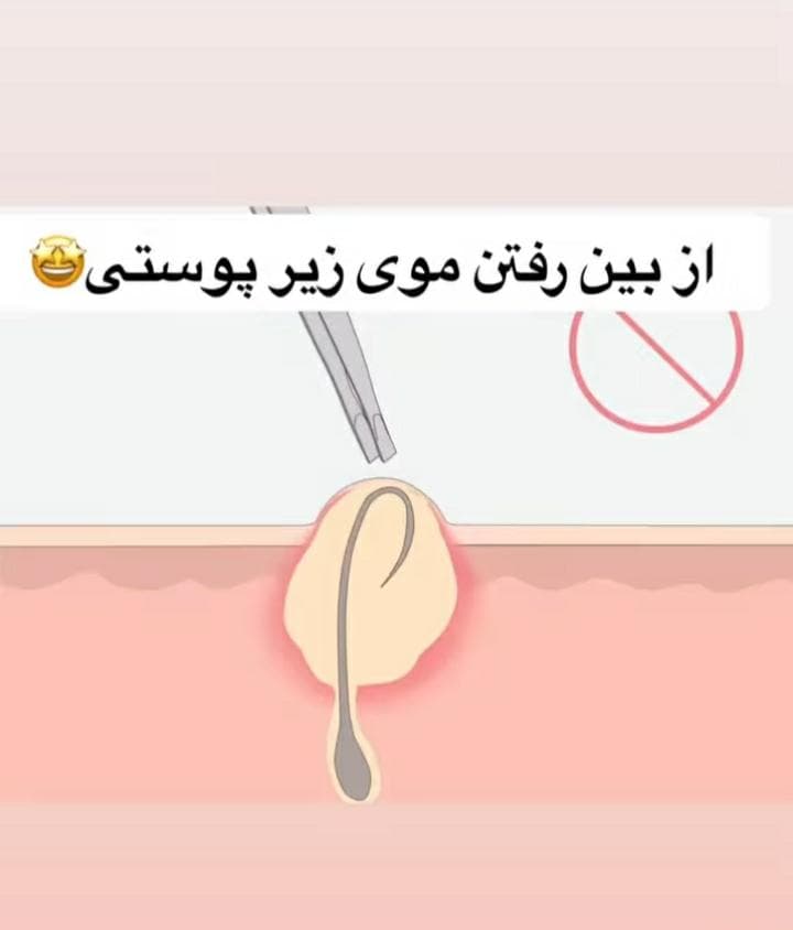 مرکز لیزر پرشین در یزد