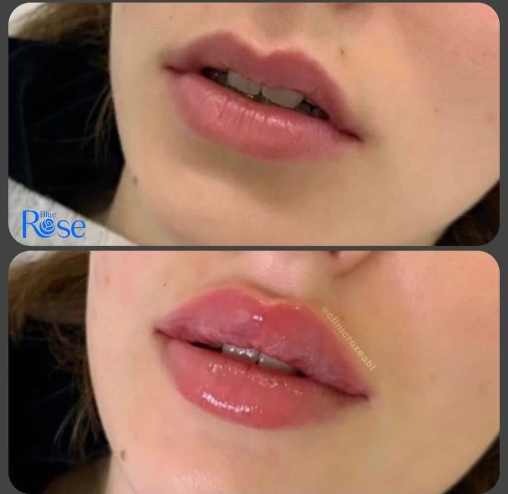 مطب پوست و مو زیبایی رز آبی در سعادت آباد تهران