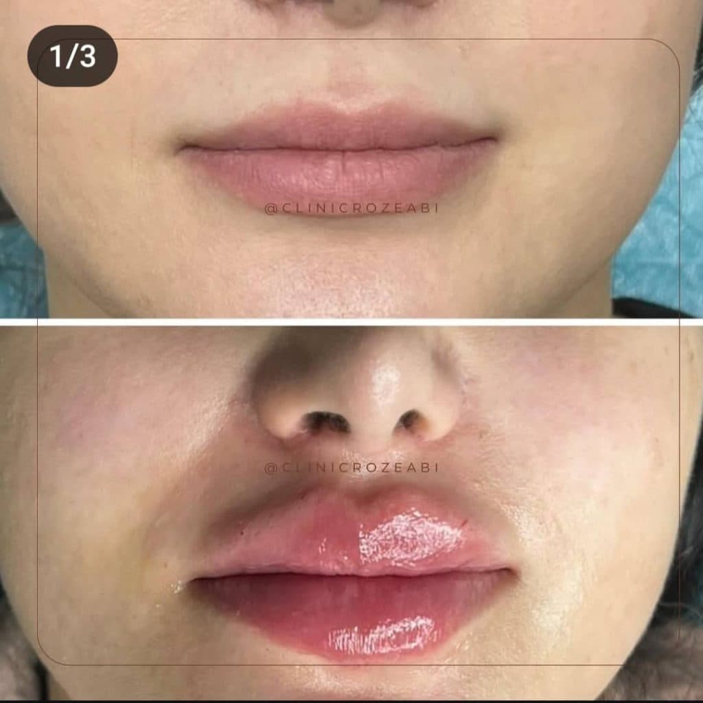 مرکز لیزر رز آبی در سعادت آباد تهران