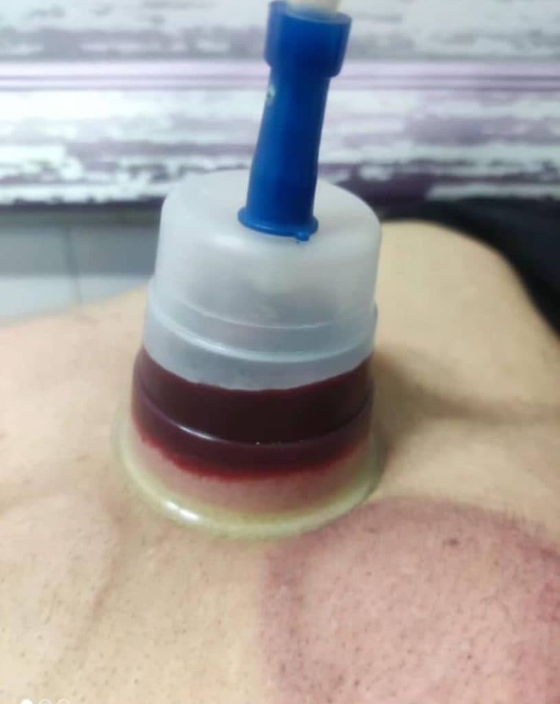 خدمات طب سنتی حکیم پیربابا افتخاری حکیم کرد در کوهسار