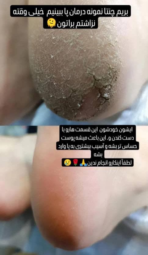 آموزش پدیکور پا مهدیه قربانی در شهرکرد