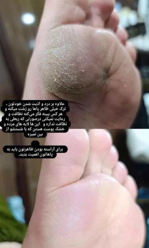 آموزش پدیکور پا مهدیه قربانی در شهرکرد
