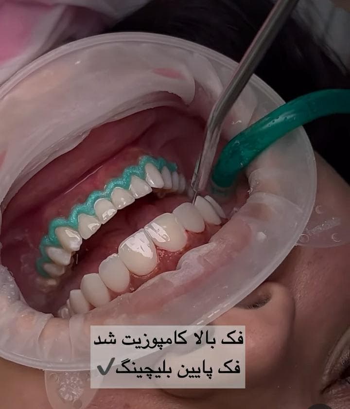 مطب دندانپزشکی دکتر نیما مهرنیا در مریوان