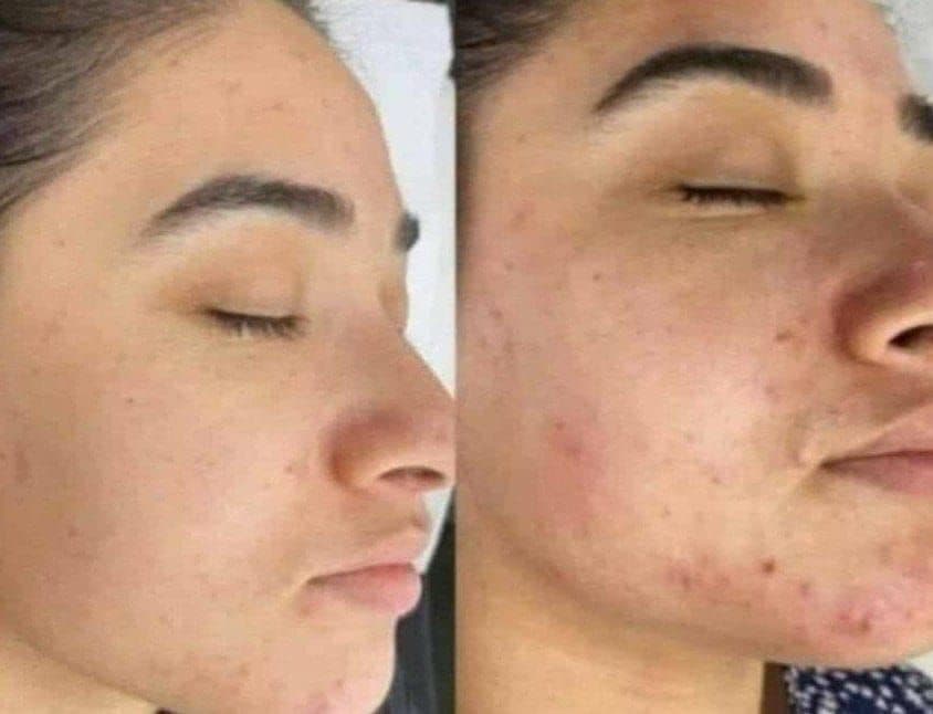 آموزش طب سنتی تیم سلاطین شهر ری