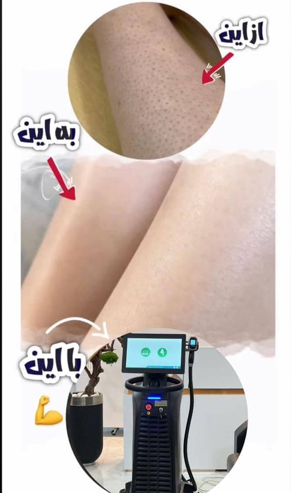 کلینیک زیبایی لاغری لوتوس در چابهار