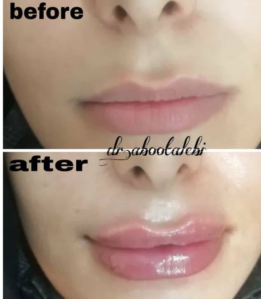 مطب زیبایی پوست و مو دکتر هدی ابوطالبی در قم 