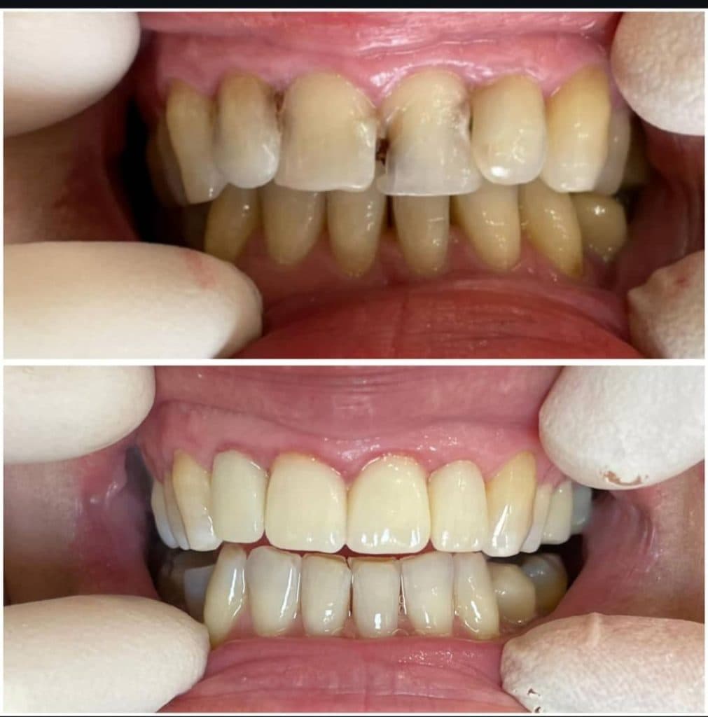 مطب دندانپزشکی دکتر علی آزادی در پردیس