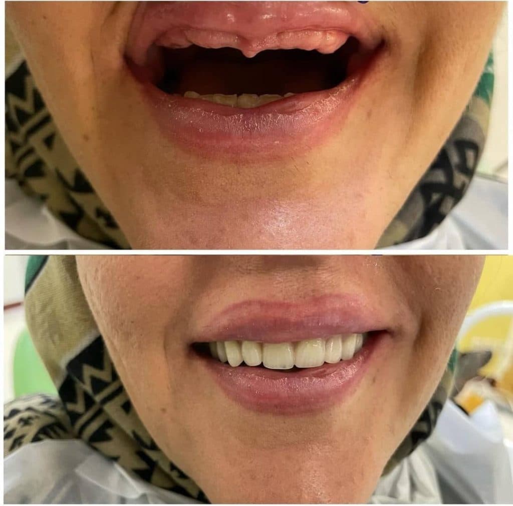 مطب دندانپزشکی دکتر علی آزادی در پردیس