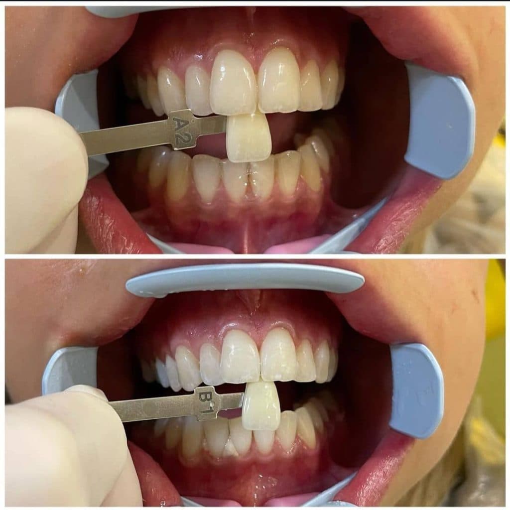 مطب دندانپزشکی دکتر علی آزادی در پردیس