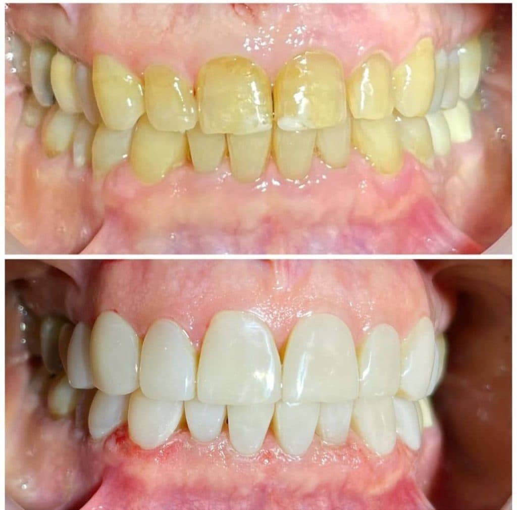 مطب دندانپزشکی دکتر علی آزادی در پردیس
