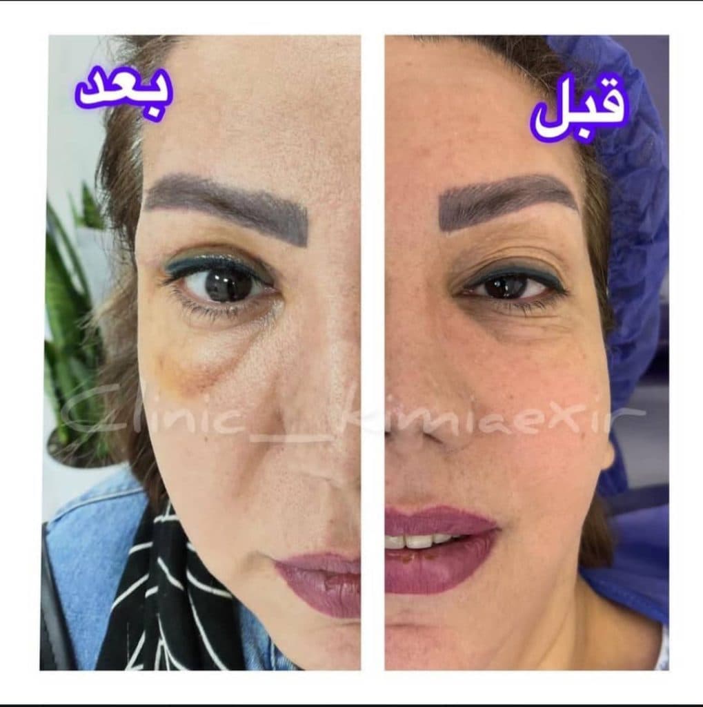 کلینیک زیبایی کیمیا اکسیر در تهرانپارس تهران