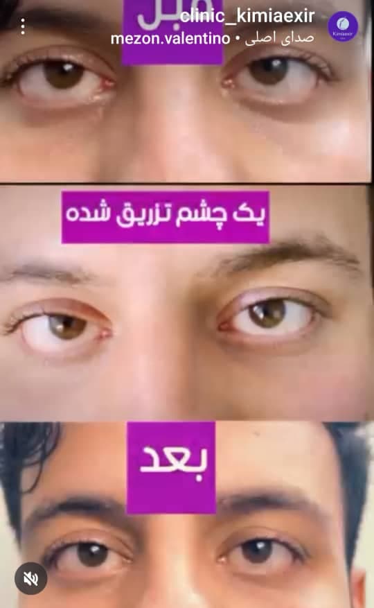 کلینیک زیبایی کیمیا اکسیر در تهرانپارس تهران