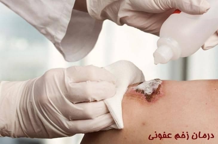 خدمات پانسمان و مدیریت زخم در منزل امیر صحبتی ملایر
