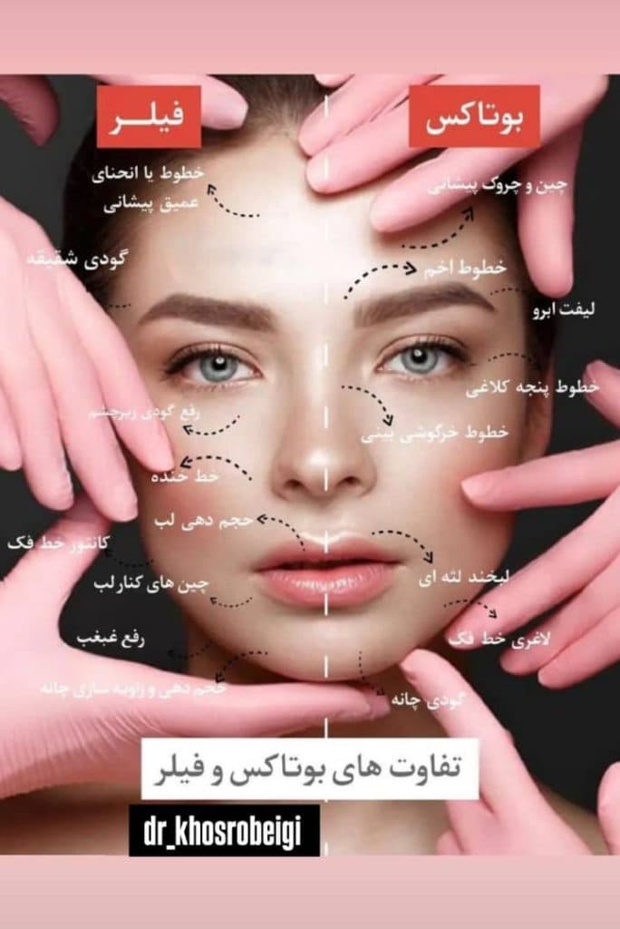 مرکز ژل و بوتاکس رز سفید در قم