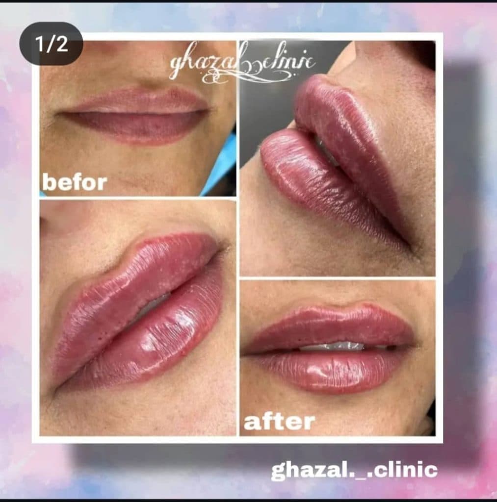 کلینیک زیبایی غزل در بوشهر