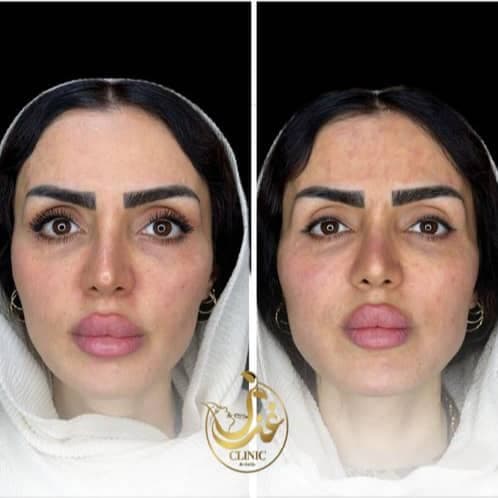 کلینیک زیبایی غزل در بوشهر