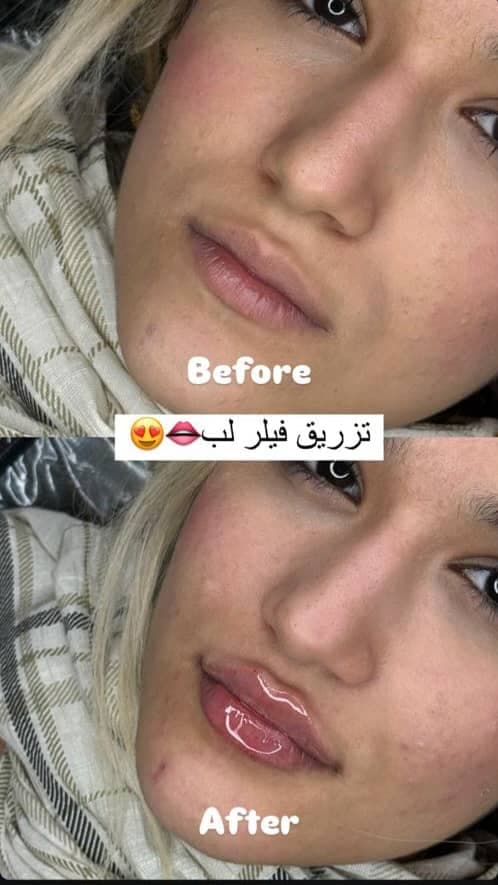 کلینیک زیبایی غزل در بوشهر