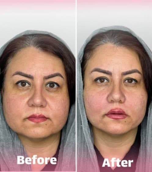 کلینیک زیبایی غزل در بوشهر