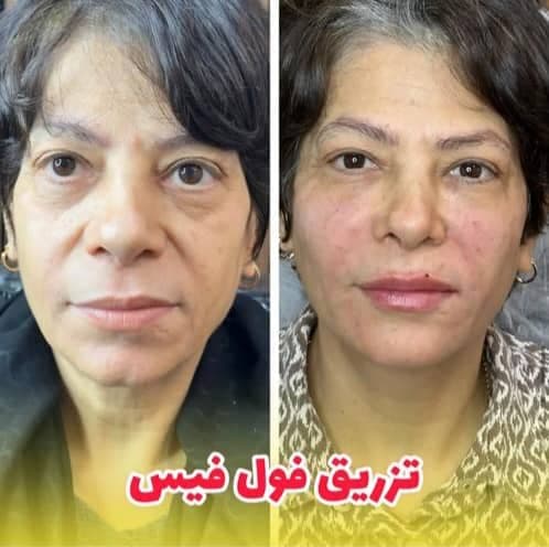 کلینیک زیبایی غزل در بوشهر