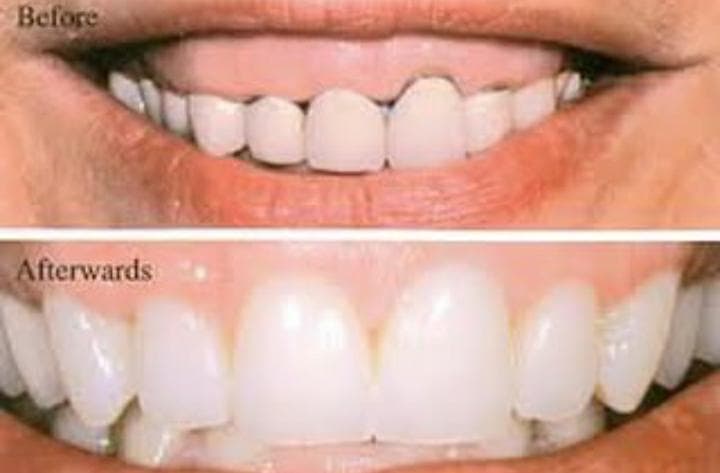 لابراتوار تخصصی دندانسازی دنتال کیش در تبریز