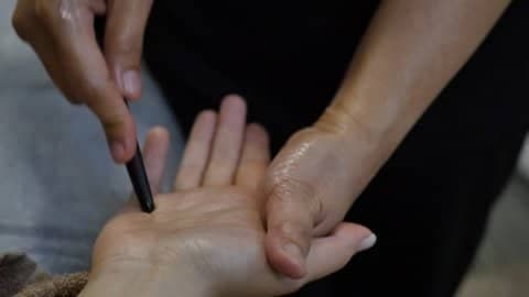 خدمات تخصصی درمانی طب سوزنی در منزل مهدی شمس در کرج