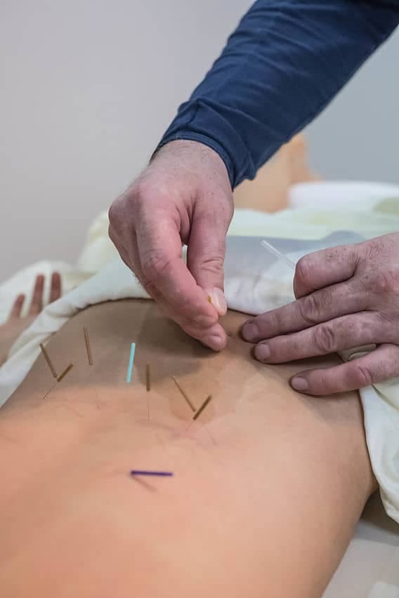 خدمات تخصصی درمانی طب سوزنی در منزل مهدی شمس در کرج