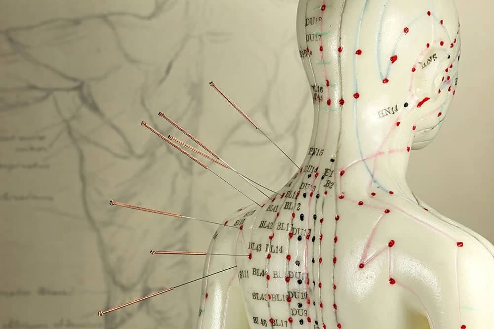 خدمات تخصصی درمانی طب سوزنی در منزل مهدی شمس در کرج