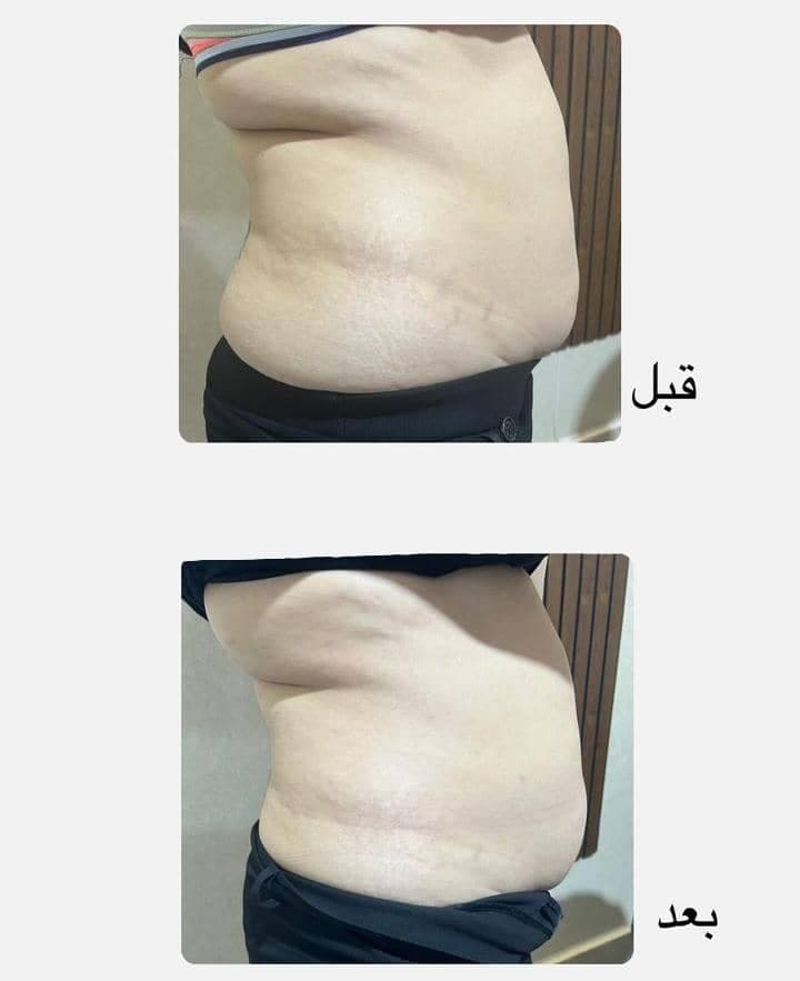 کلینیک زیبایی لاغری لوتوس در چابهار