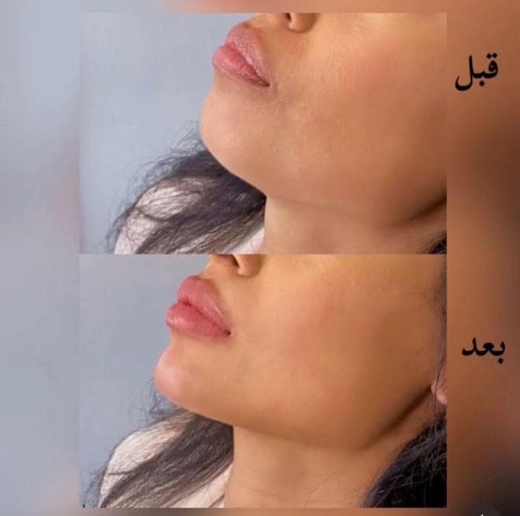 کلینیک زیبایی بهارک جوانی در ستارخان تهران