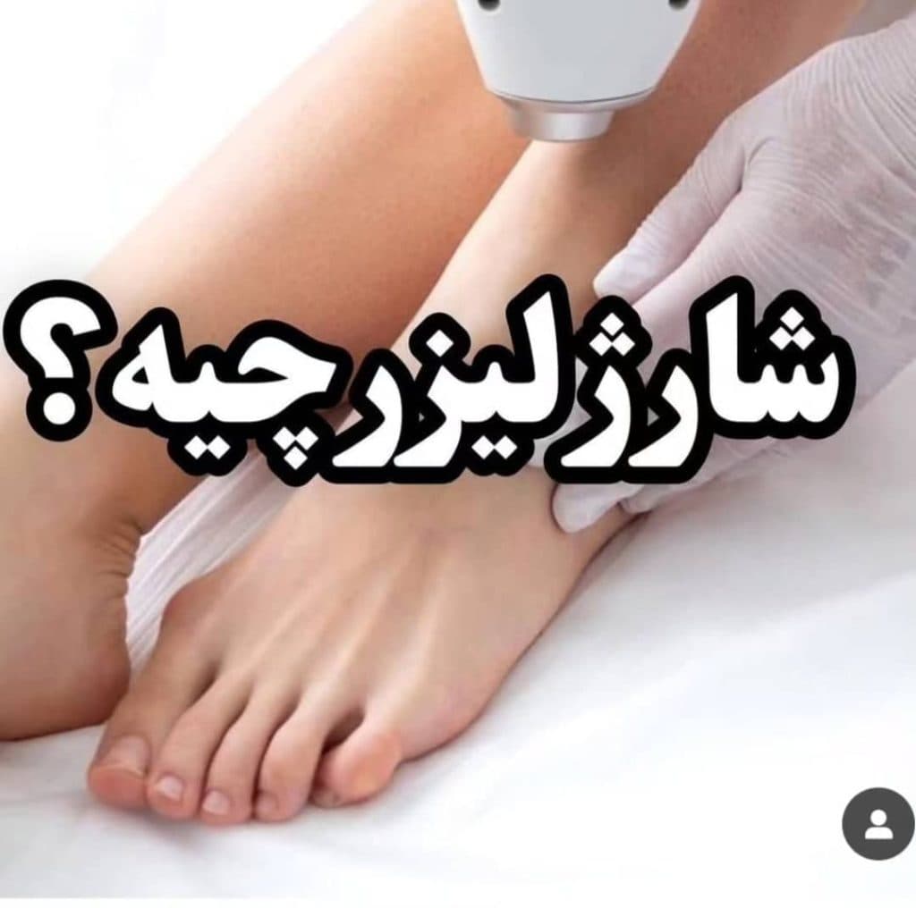 مرکز لیزر ملکه در چابهار