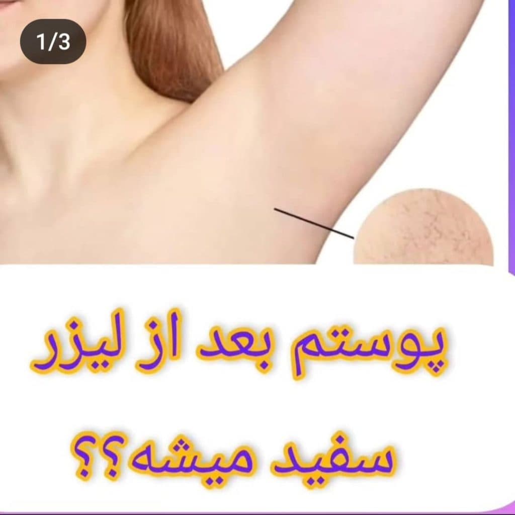 مرکز لیزر ملکه در چابهار