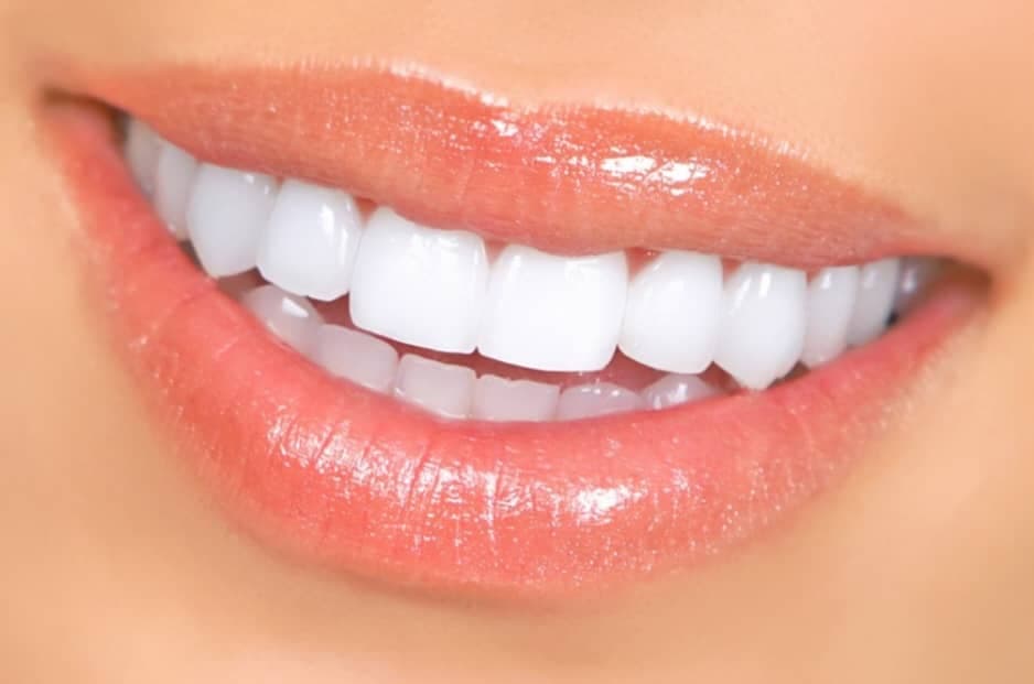طراحی و اجرای زیبایی دندان و کامپوزیت مازدنت در کرمانشاه
