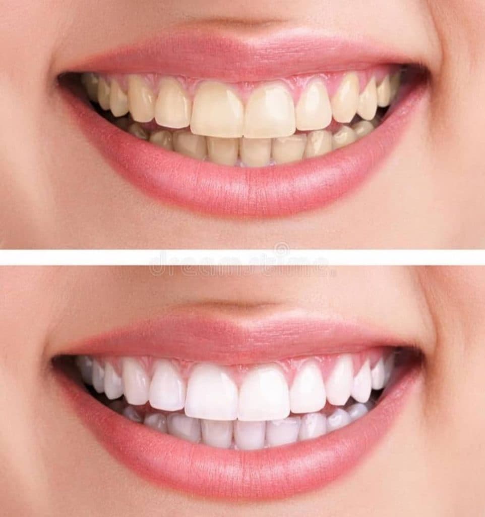 کلینیک دندانپزشکی سیب در گلشهر تبریز