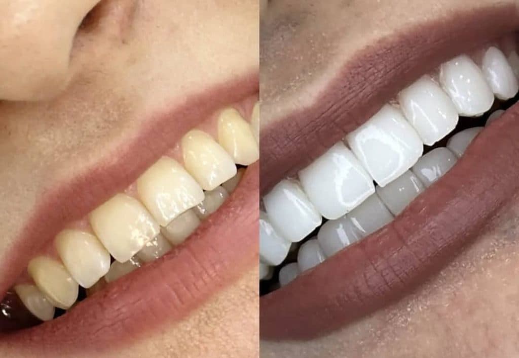 کلینیک دندانپزشکی سیب در گلشهر تبریز
