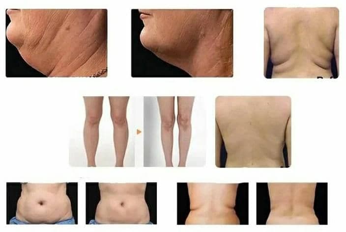 مرکز لاغری و رژیم درمانی آسمان آبی اصفهان