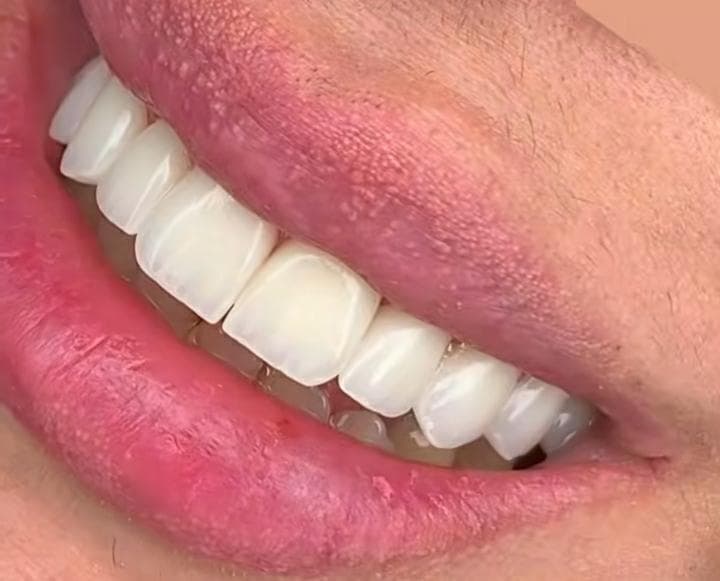لابراتوار تخصصی دندانسازی دنتو پلاس کریمی در تبریز
