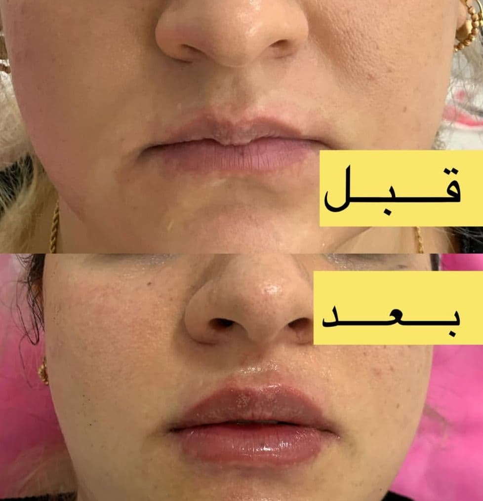 کلینیک زیبایی رافا در عبدل آباد تهران