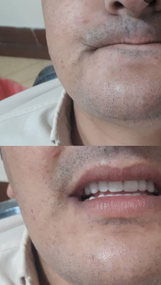 لابراتوار تخصصی دندان سازی و دیجیتال ایده آل در امام خمینی لنگرود