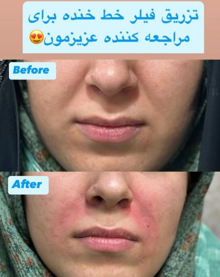 کلینیک زیبایی بهارک جوانی در ستارخان تهران