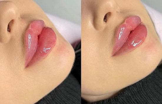 مطب زیبایی آفتاب در تهرانپارس تهران