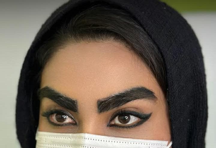 مرکز تخصصی کاشت مو و ابرو به سیما beh sima در قم