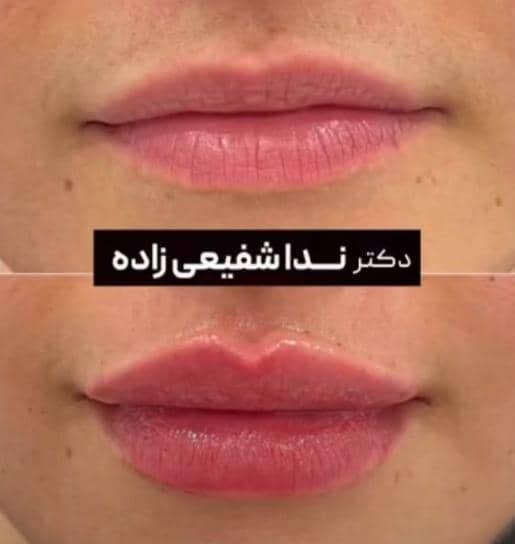 کلینیک زیبایی دکتر ندا شفیعی زاده در کرج