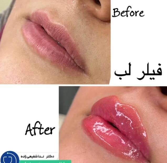 کلینیک زیبایی دکتر ندا شفیعی زاده در کرج