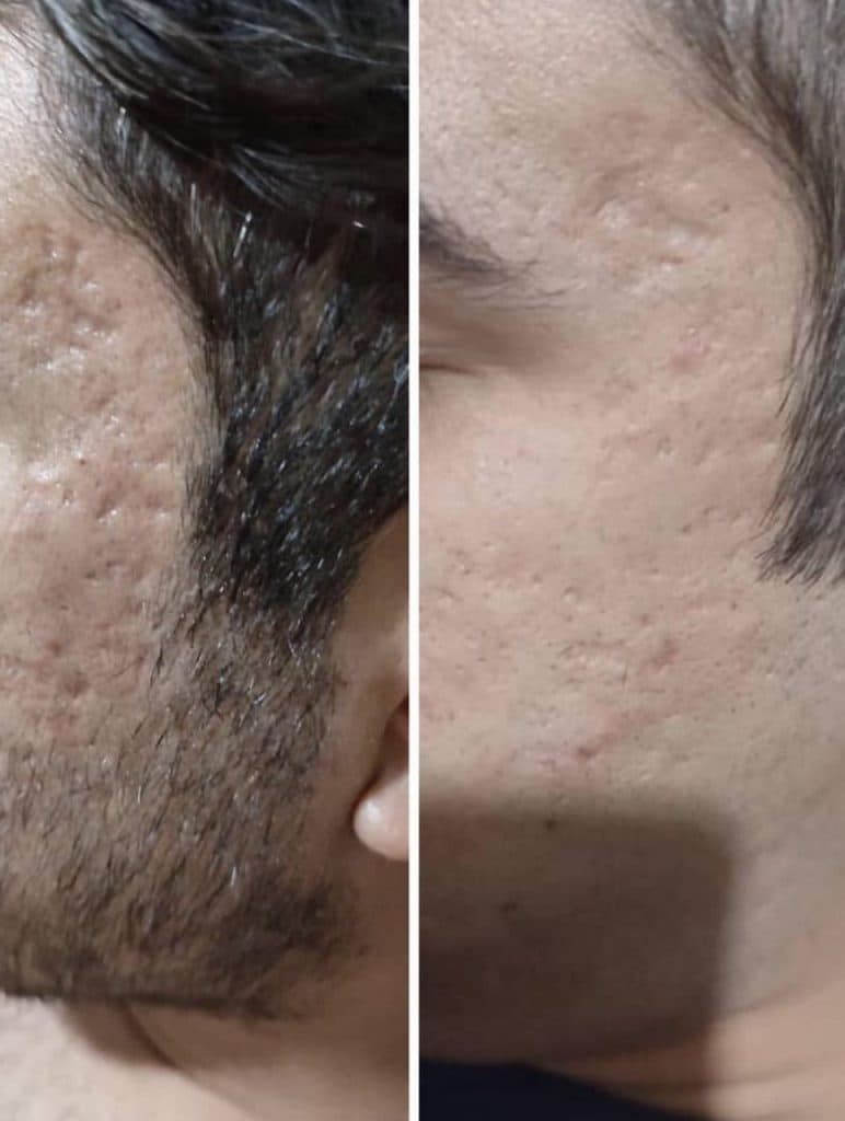 مرکز تخصصی فیشیال و جوانسازی پوست آویژه در چهارراه طالقانی کرج