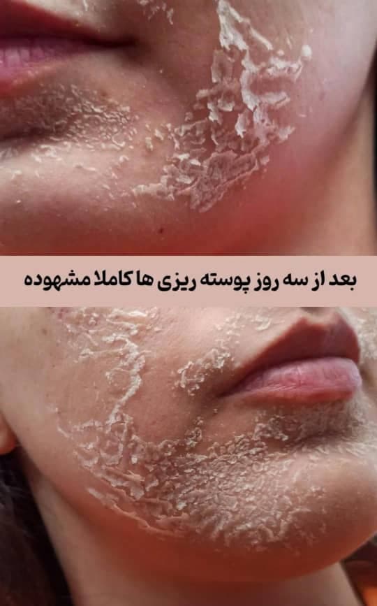 آموزش و خدمات تخصصی گرین پیل و اسپیکیول تراپی نازنین شاهرخی در اراک